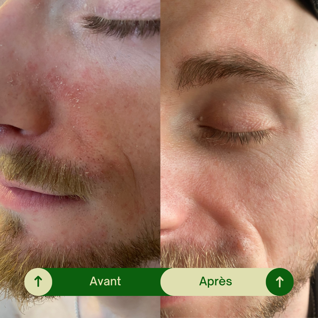 Routine minimaliste peaux sensibles - Soin & réparation